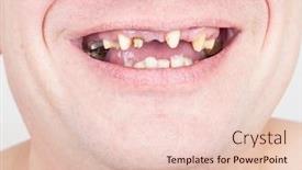  Presentation with dentistry - Beautiful presentation featuring dentistry-missing-teeth backdrop and a lemonade colored foreground