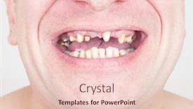  Presentation with dentistry - Colorful slide set enhanced with dentistry-missing-teeth backdrop and a lemonade colored foreground