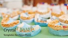  Presentation with dental prosthesis - PPT layouts having denture prosthesis production at dental background and a  colored foreground