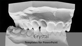  Presentation with denture - PPT theme having denture-white-gypsum-print-plaster background and a light gray colored foreground