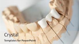  Presentation with dental laboratory - PPT theme having deontology - technical shots on a dental background and a lemonade colored foreground