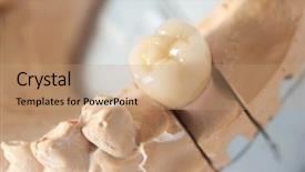  Presentation with dental laboratory - PPT theme consisting of deontology - technical shots on a dental background and a coral colored foreground