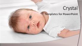  Presentation with allergy - Beautiful PPT theme featuring dermatitis - adorable baby with skin allergy backdrop and a lemonade colored foreground