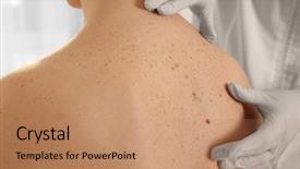  Presentation with clinic - Beautiful PPT theme featuring dermatologist examining patient in clinic backdrop and a  colored foreground