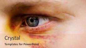  Presentation with domestic violence - Amazing theme having detail of a woman - purple backdrop and a  colored foreground