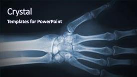  Presentation with xray - Theme consisting of detail of hand xray film background and a wine colored foreground