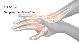  Presentation with bone - Colorful PPT theme enhanced with digital composite of highlighted bones backdrop and a white colored foreground