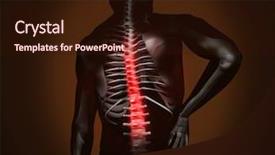  Presentation with back pain - Colorful PPT theme enhanced with digital man with back pain backdrop and a wine colored foreground