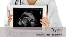  Presentation with baby ultrasound - Cool new slide set with digital tablet with ultrasound scan backdrop and a light gray colored foreground