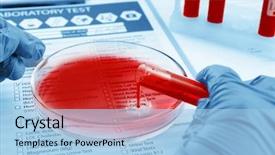  Presentation with petri dish - Presentation with storage disease - doctor's hand pouring blood sample background and a light blue colored foreground