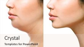  Presentation with perfect - PPT layouts having disease - part of face woman background and a lemonade colored foreground