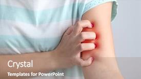  Presentation with allergies - Presentation theme enhanced with disease malaria - allergies concept woman scratching arm background and a coral colored foreground