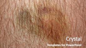  Presentation with flexible skin electronics - Presentation design enhanced with tissue disorders - nasty looking bruise on man's background and a coral colored foreground