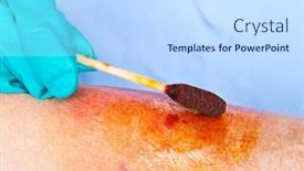  Presentation with wound - PPT theme consisting of doctor-cleans-a-wound background and a sky blue colored foreground
