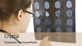  Presentation with brain injury - Presentation theme enhanced with doctor examining a brain cat background and a coral colored foreground