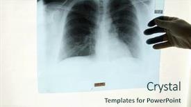  Presentation with lung - Slide deck consisting of doctor examins an x-ray background and a sky blue colored foreground