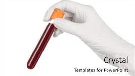  Presentation with blood test - Audience pleasing theme consisting of doctor holding red blood backdrop and a white colored foreground
