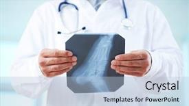  Presentation with human foot - Beautiful slide set featuring doctor holding x-ray backdrop and a light blue colored foreground