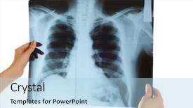  Presentation with doctor - PPT theme with doctor looking at x-ray background and a light blue colored foreground