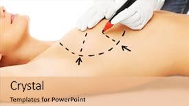  Presentation with breast surgery - Slide set having doctor marking breast for surgery background and a coral colored foreground