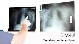  Presentation with metabolic doctor examining - PPT theme enhanced with doctor or x-ray tec background and a white colored foreground