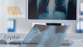  Presentation with radiologist - PPT theme with doctor radiologist looking at x-ray images background and a light blue colored foreground