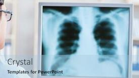  Presentation with radiologist - Cool new PPT theme with doctor-radiologist-looking-at-x backdrop and a light blue colored foreground
