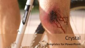  Presentation with wound - Cool new slides with downfall - man with a wound backdrop and a  colored foreground