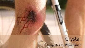  Presentation with wound - Audience pleasing presentation design consisting of downfall - man with a wound backdrop and a  colored foreground