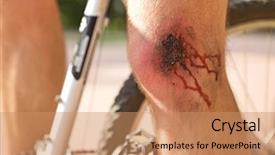  Presentation with wound - Amazing presentation having downfall - man with a wound backdrop and a  colored foreground