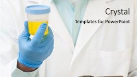  Presentation with urine - Slide set having drugs - doctor holding a urine sample background and a white colored foreground