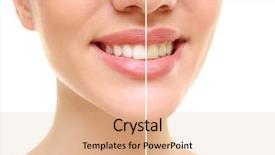  Presentation with teeth whitening - PPT theme featuring enamel dental - result of teeth whitening smiling background and a coral colored foreground