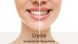  Presentation with teeth whitening - Beautiful theme featuring enamel dental - result of teeth whitening smiling backdrop and a lemonade colored foreground