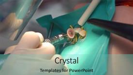  Presentation with endodontics - PPT layouts featuring endodontics - abrasive dentist equipment background and a seafoam green colored foreground