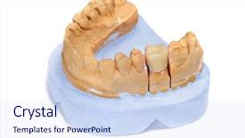  Presentation with dental prosthesis - Amazing PPT layouts having endodontics - dental mold with a prosthesis backdrop and a sky blue colored foreground