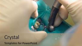  Presentation with endodontics - Slides featuring endodontics - dentist equipment background and a coral colored foreground