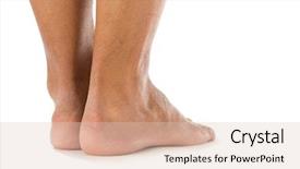  Presentation with bone - Audience pleasing presentation theme consisting of enlargement - abnormality of the bone backdrop and a lemonade colored foreground