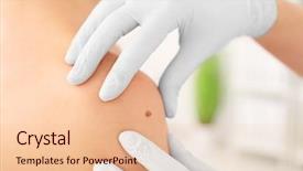  Presentation with bile cancer - Presentation design having examining patient in clinic cancer background and a lemonade colored foreground