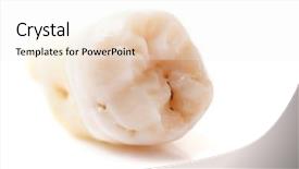  Presentation with wisdom - Theme consisting of extracted wisdom tooth caries is background and a sky blue colored foreground