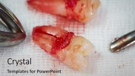  Presentation with dental extraction - Theme having extraction of tooth with dental background and a  colored foreground