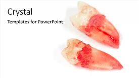  Presentation with dental extraction - Audience pleasing PPT layouts consisting of extraction of tooth with dental backdrop and a  colored foreground