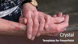  Presentation with skin disease - Amazing slides having extreme psoriasis skin disease backdrop and a tawny brown colored foreground