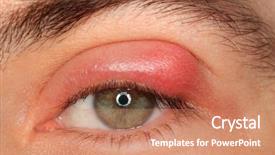  Presentation with serial killers and mental illness - Cool new theme with sti - illness person eye with sty backdrop and a coral colored foreground