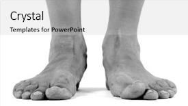  Presentation with arches - Colorful presentation enhanced with fallen arches flat feet backdrop and a light gray colored foreground