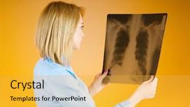  Presentation with asian doctor obese patient - Beautiful PPT theme featuring female doctor carefully x-ray backdrop and a yellow colored foreground