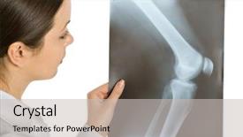  Presentation with knee - Cool new presentation design with female doctor looking x-ray backdrop and a light gray colored foreground