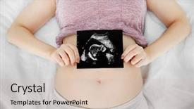  Presentation with ultrasound - Theme having female hands holding ultrasound photo on belly closeup background and a soft green colored foreground
