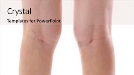  Presentation with veins - Slide set featuring female legs on white background background and a coral colored foreground