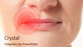  Presentation with herpes virus - PPT theme featuring female lips with herpes virus background and a lemonade colored foreground