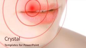  Presentation with herpes virus - Slide set consisting of female lips with herpes virus background and a lemonade colored foreground